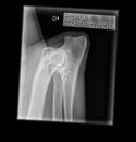 Elbow Left 11/8-2021