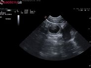 Ultraschall