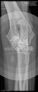 00000000_DICOM_DX_2020_10_22_0000606611.jpg