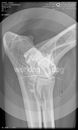 00000000_DICOM_DX_2020_10_22_0000606606.jpg
