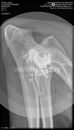 00000000_DICOM_DX_2020_10_22_0000606609.jpg