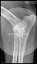 00000000_DICOM_DX_2020_10_22_0000606610.jpg