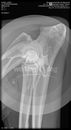 00000000_DICOM_DX_2020_10_22_0000606605.jpg