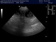 A Wurf Ultraschall